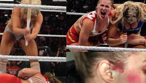 La excampeona de la UFC también ha pedido la revancha y lo hizo compartiendo las fotos más violentas de su combate contra Charlotte Flair en las Survivor Series.