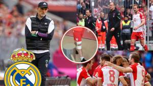Bayern Múnich podría perder por lesión hasta a tres jugadores de cara al partido del martes en el Allianz Arena ante el Real Madrid en la ida de las semis de Champions.