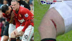 Así fue la herida que sufrió Ronney, delantero de los Diablos Rojos del Manchester United.
