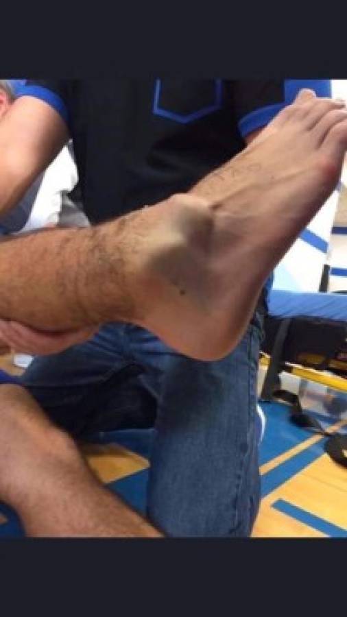 Las lesiones más escalofriantes que se han dado en el fútbol, André Gomes el último  