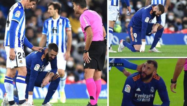 Karim Benzema se marcha del campo en el primer tiempo ante la Real Sociedad por una lesión y estos son los partidos que será baja con Real Madrid.