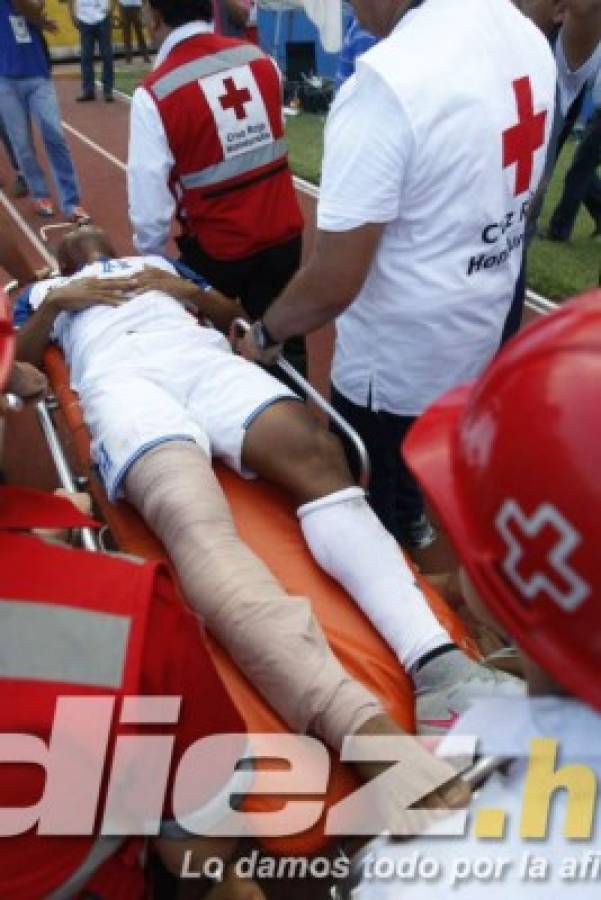 Así se recuperó Garrido de la lesión por la que le hubiesen cortado la pierna
