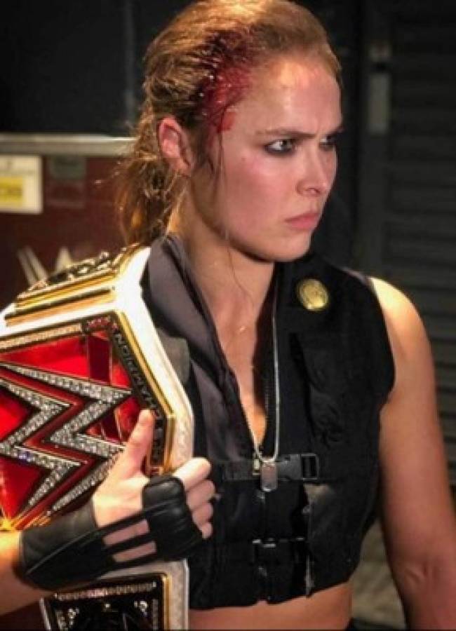 ¡Impactante! Así quedó el rostro de Ronda Rousey tras una pelea de 'muletazos' en WWE