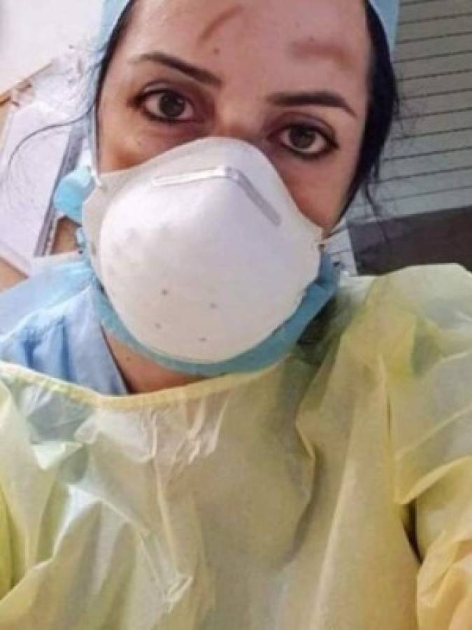 Fotos: Así lucen los rostros de los doctores que luchan contra el coronavirus