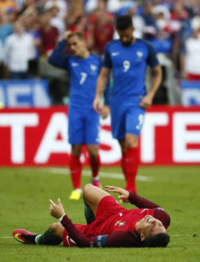 Fotos: El drama de Cristiano Ronaldo por su dura lesión ante Francia