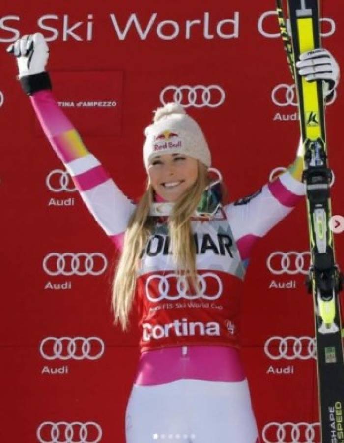 Lindsey Vonn, la campeona del mundo a la critican por su cuerpo: 'Soy 100% natural, sin botox'