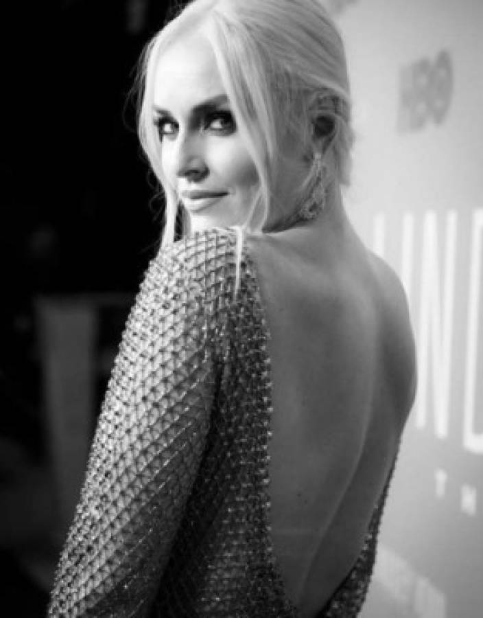 Lindsey Vonn, la campeona del mundo a la critican por su cuerpo: 'Soy 100% natural, sin botox'