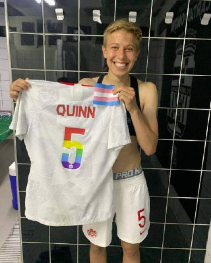 Quinn, el primer medallista transgénero no binario en Juegos Olímpicos: su pronombre es They/Them