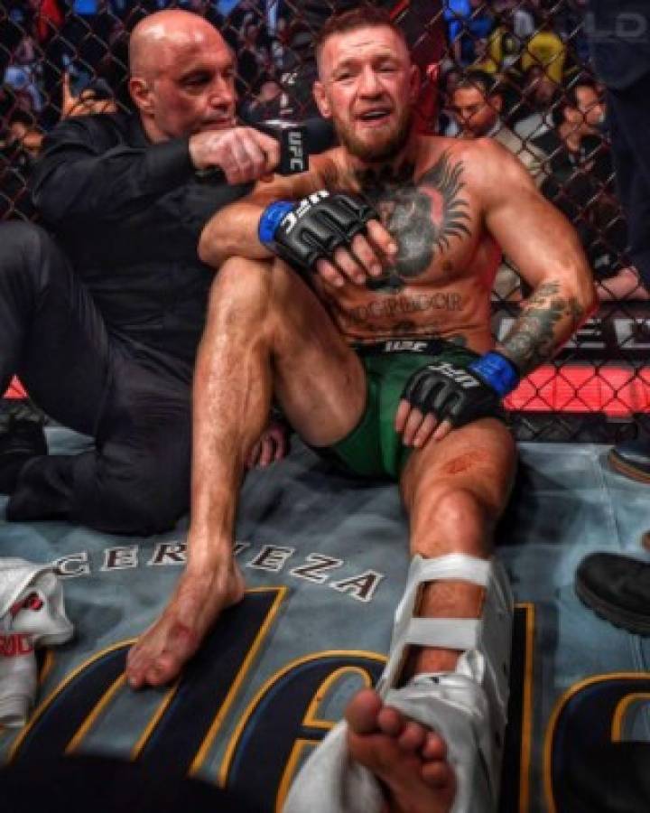 Espeluznantes imágenes: Así quedó la pierna de McGregor tras sufrir una fractura en la UFC