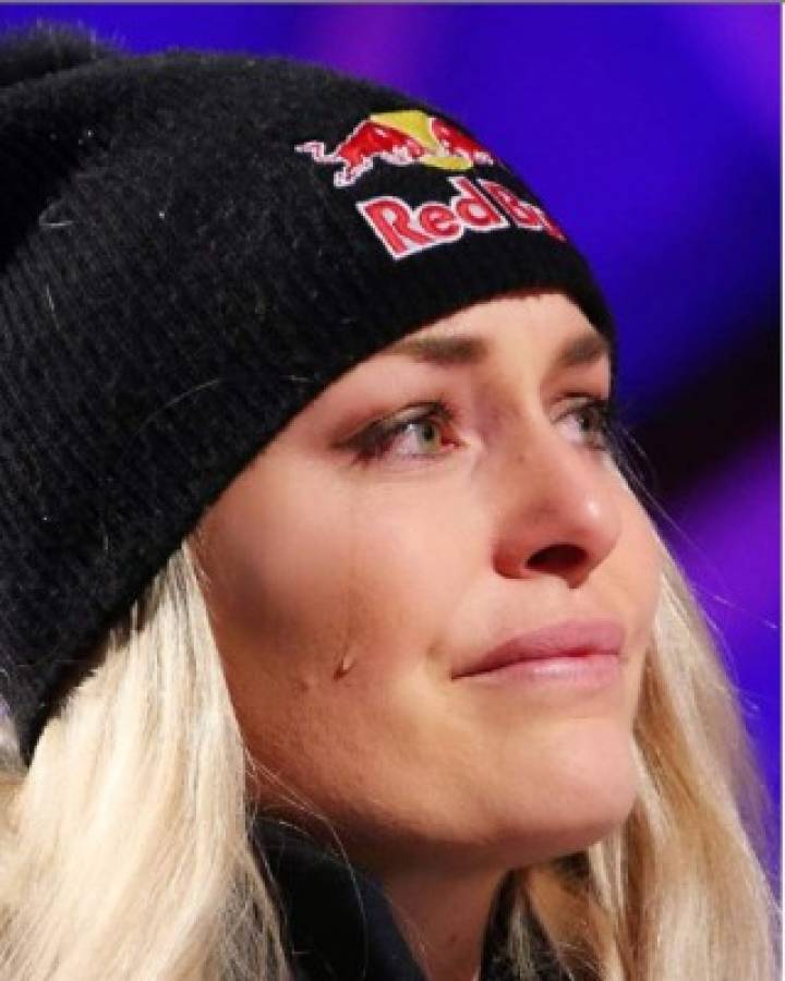 Así luce Lindsey Vonn , la ganadora del Premio Princesa de los Deportes de Asturias