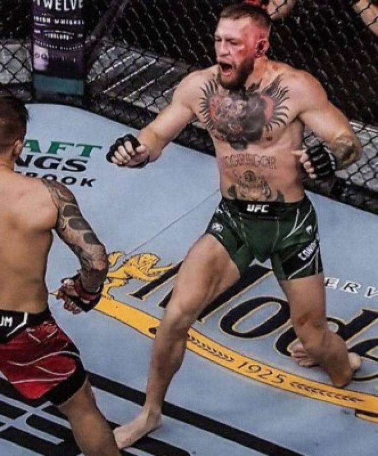 Espeluznantes imágenes: Así quedó la pierna de McGregor tras sufrir una fractura en la UFC