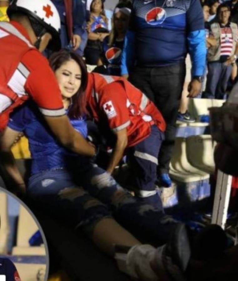 Presentadora que sufrió lesión tras avalancha en la final Motagua-Saprissa deja el hospital