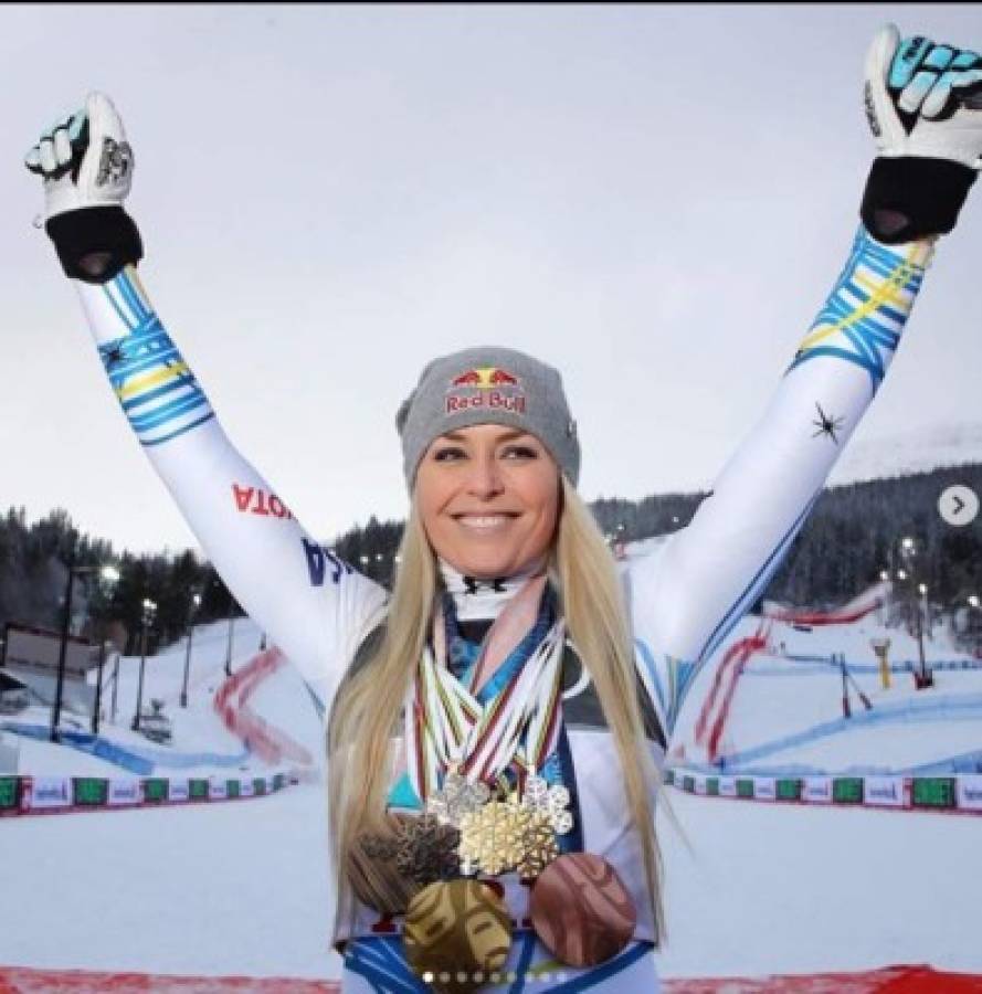 Lindsey Vonn, la campeona del mundo a la critican por su cuerpo: 'Soy 100% natural, sin botox'