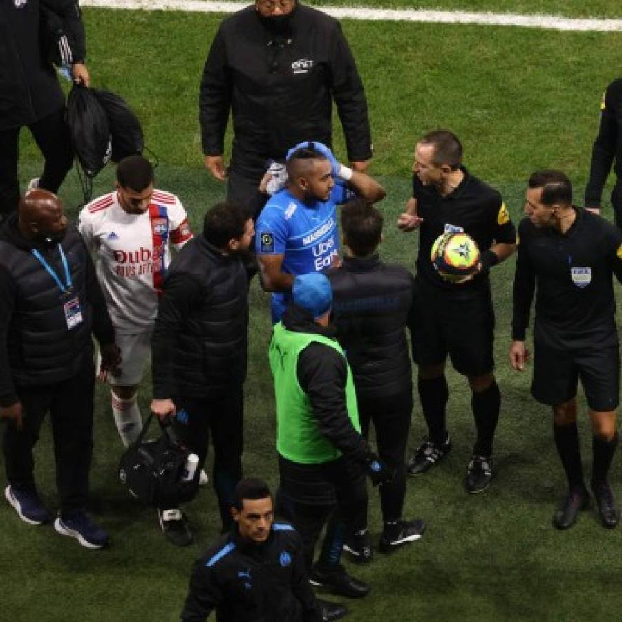 Fotos: Así fue la agresión que sufrió Payet en la Liga de Francia; ¡botellazo en la cabeza!