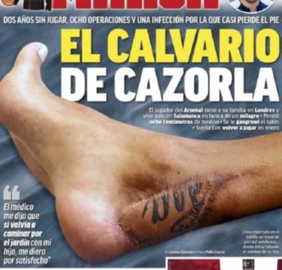 Impactante: La lesión que tiene retirado del fútbol a bicampeón de Euro con España