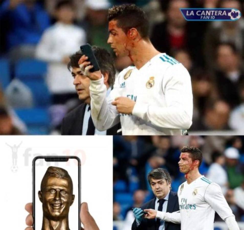 ¡VIRAL! Los memes de Cristiano Ronaldo por mirar su herida en el celular