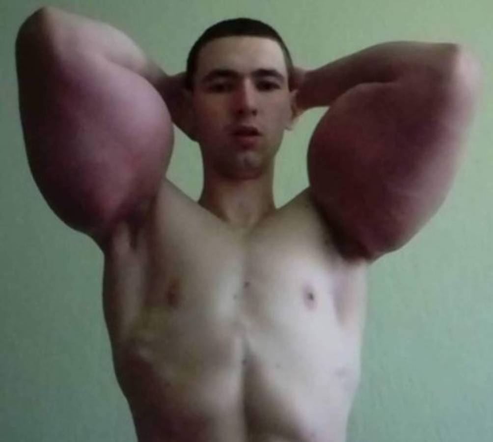 Así es el ''Popeye'' ruso, el luchador que fue humillado durante su debut en la MMA