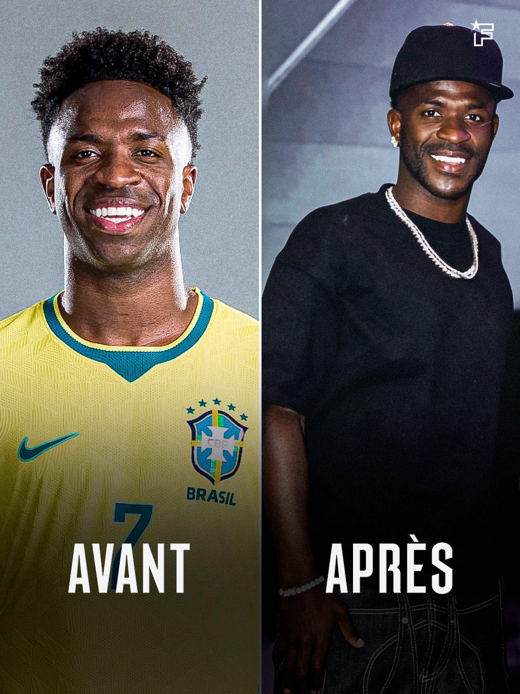 Vinicius pasa por el quirófano y sorprende a todos con su nuevo rostro tras el Mundial