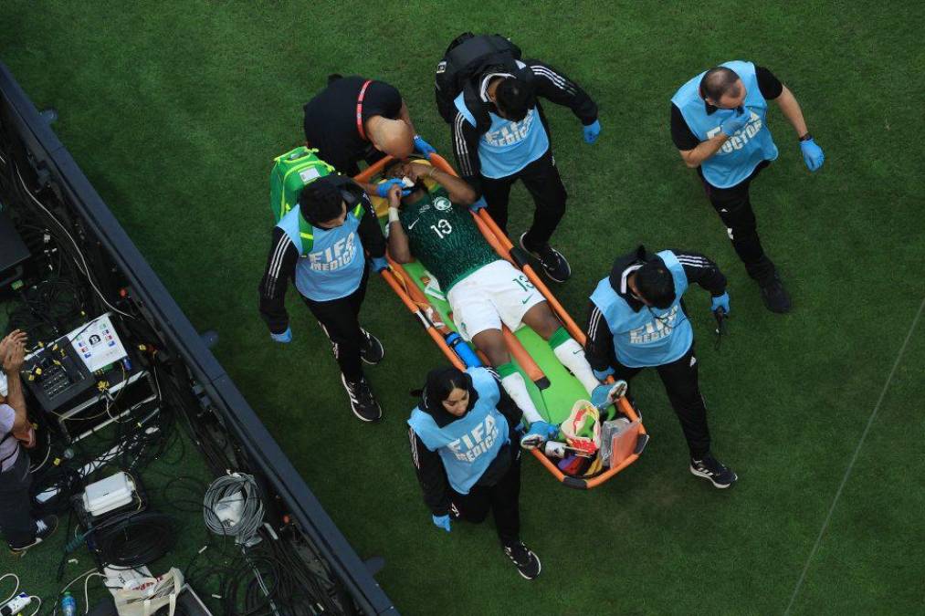 ¡Impactante momento! Confirman alcance de la lesión de Al Shahrani, jugador de Arabia Saudí tras vencer a Argentina