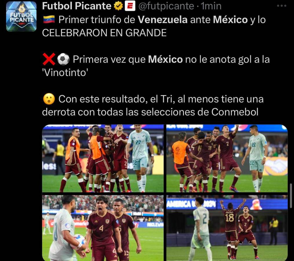 Faitelson y la prensa reacciona a la derrota de México ante Venezuela en la Copa América: “Somos una porquería”
