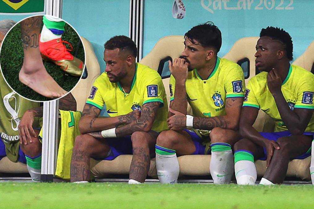 El tobillo de Neymar preocupa a Tite y a toda Brasil después del partido contra Serbia