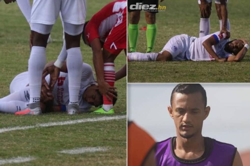 Olimpia pierde por nueve meses a Carlos Pineda; Jorge Álvarez y Diego Reyes jugarán hasta el Clausura