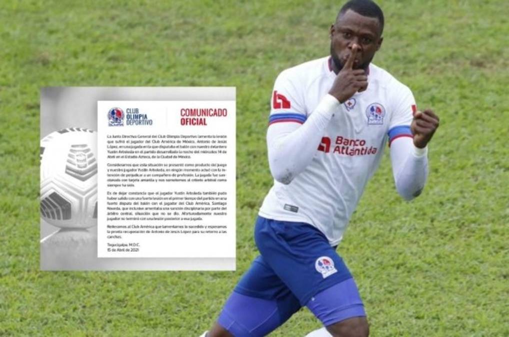 Olimpia le responde al América y defiende a Yustin Arboleda por la fractura de Chucho López