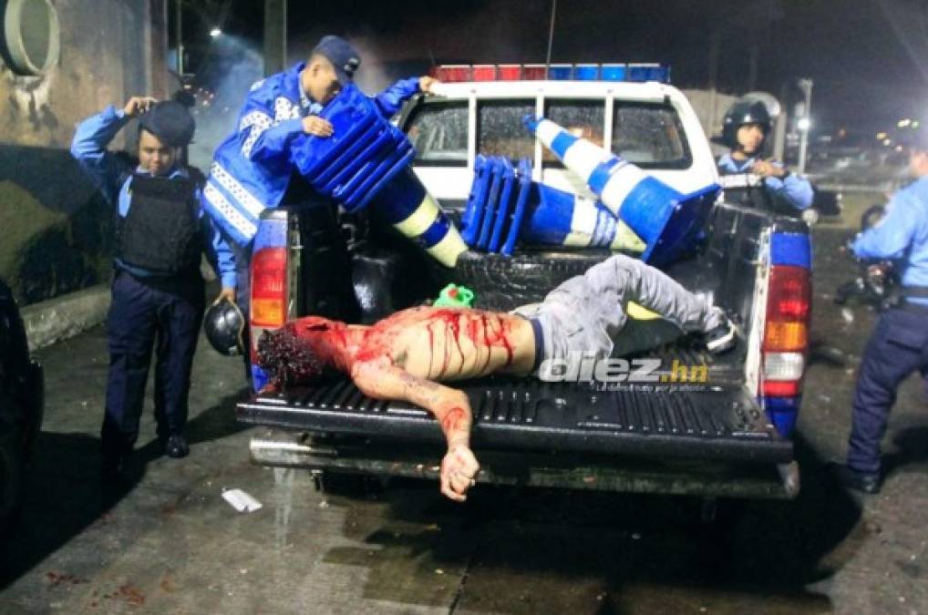 Olimpia-Motagua: La crónica de una noche trágica y de luto del clásico nacional en Honduras