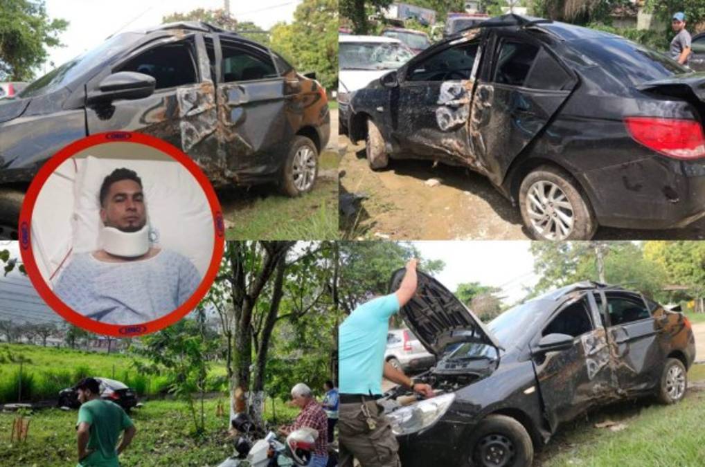 En fotos: Así quedó el auto de Marcelo Canales tras su aparatoso accidente en El Progreso