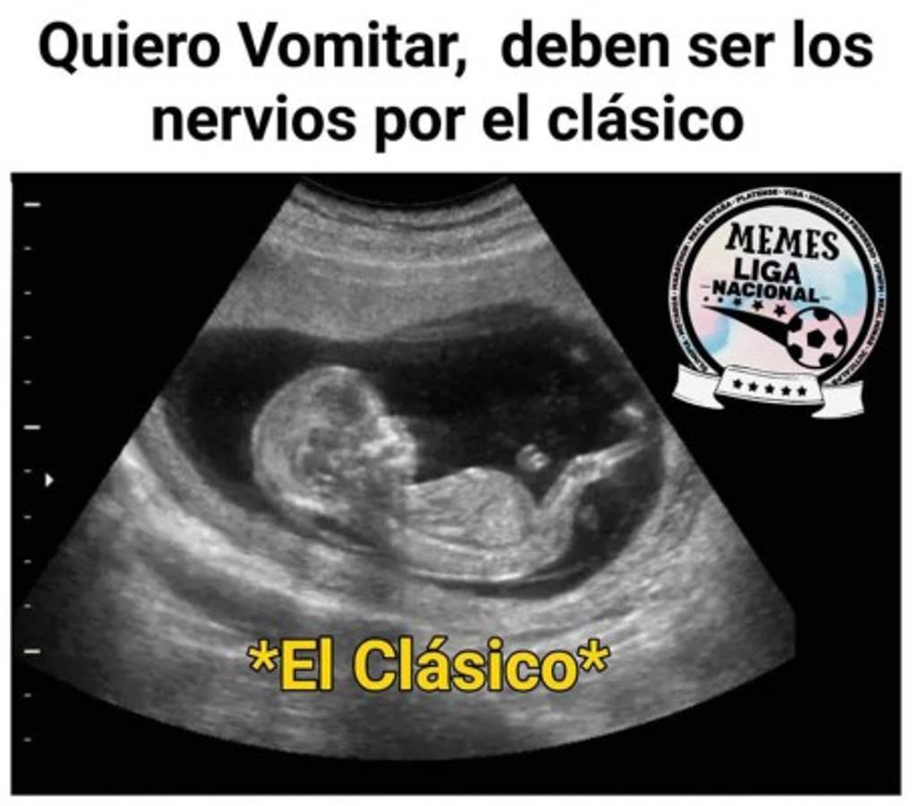 Memes: 'Trituran' al Motagua por dejar escapar el gane en el clásico ante Olimpia