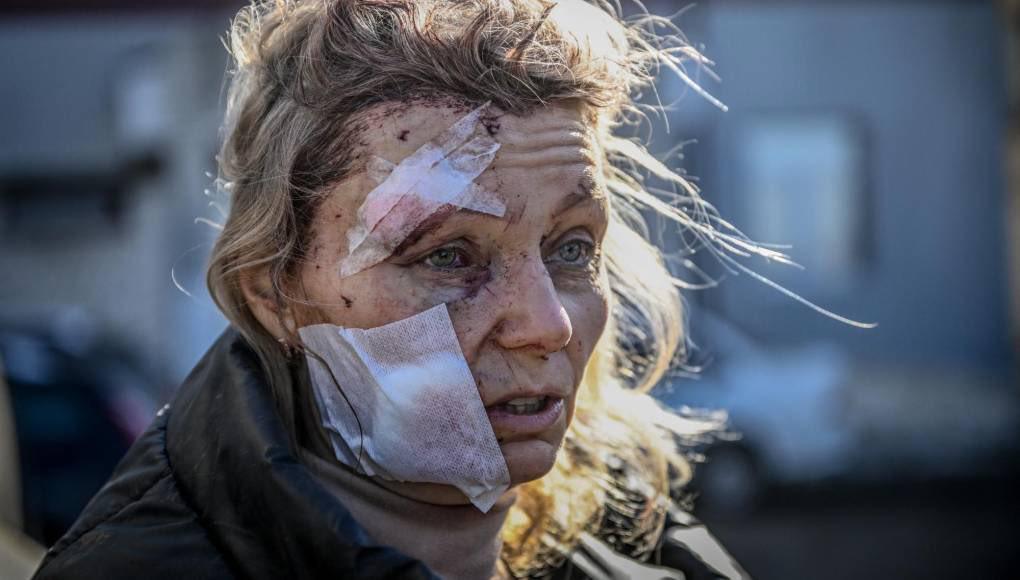 Putin busca la destrucción total: Así es la bomba de racimo, el arma prohibida que Rusia está utilizando para atacar Ucrania