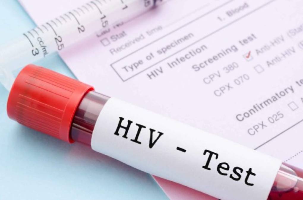 Hombre brasileño sería la primera persona en 'curarse' de VIH con tratamiento experimental