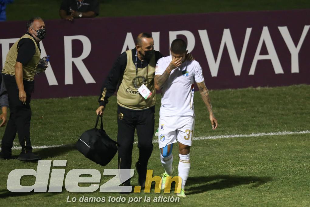 FOTOS: La tristeza de Diego Vázquez rumbo al camerino, las agresiones a jugadores chapines y la chica motagüense que hizo explotar el palco