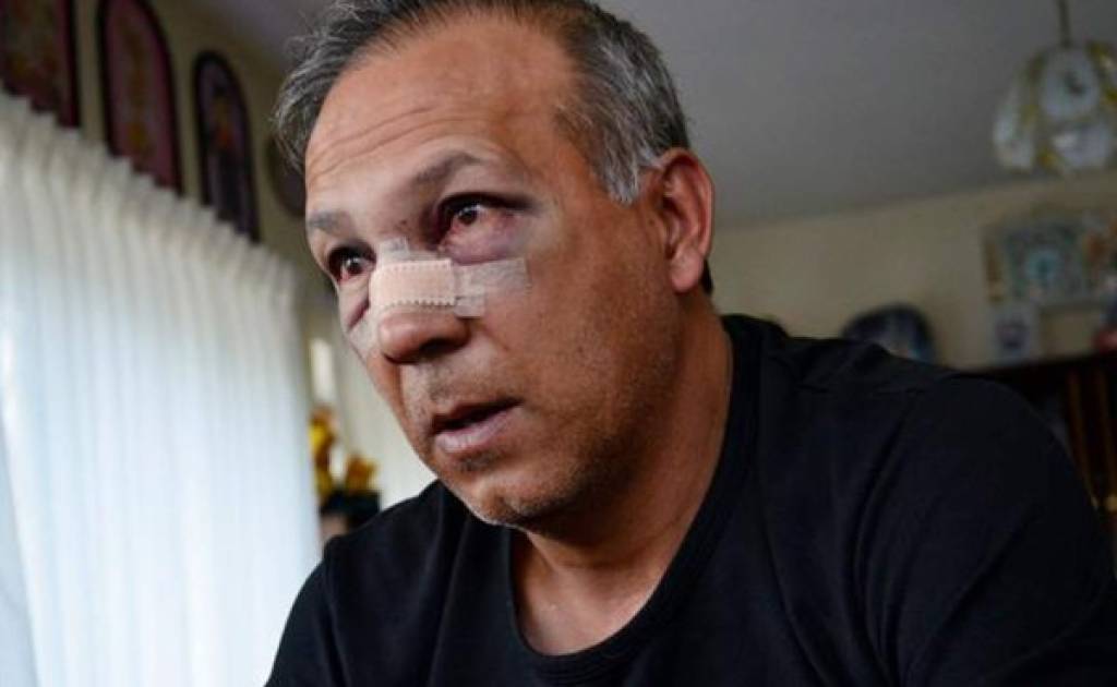 Técnico boliviano sufre fractura de nariz golpeado por jugador de su equipo