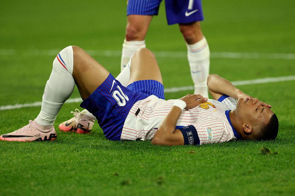 Fotos: Así le quedó la nariz a Mbappé tras rompérsela y lo que informan desde Francia sobre su lesión: “Es lo malo de esta noche”