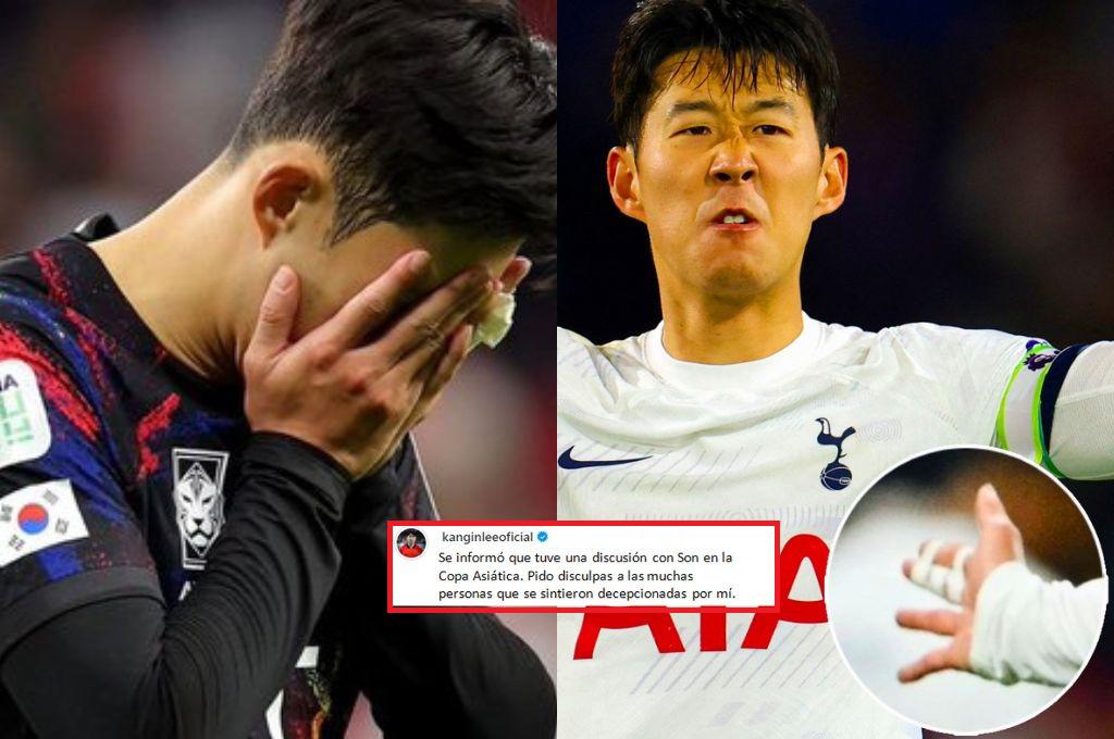 Son Heung-Min sale herido tras una pelea y revelan el insólito motivo del altercado: Así quedó su mano