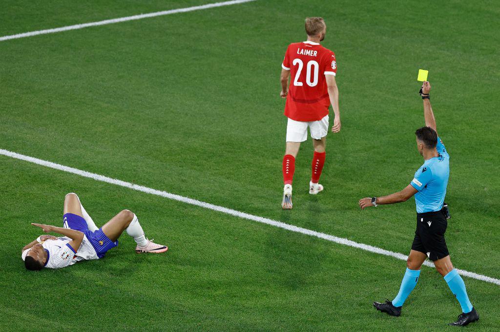 Mbappé se rompe, dardo de MisterChip a Kylian y Griezmann terminó lleno de sangre en el debut de Francia en la Eurocopa