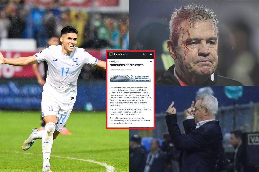 Concacaf emite comunicado por agresión a Javier Aguire ¿Qué castigos puede recibir Honduras?