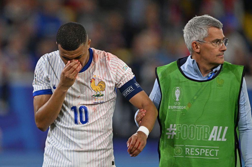 Fotos: Así le quedó la nariz a Mbappé tras rompérsela y lo que informan desde Francia sobre su lesión: “Es lo malo de esta noche”