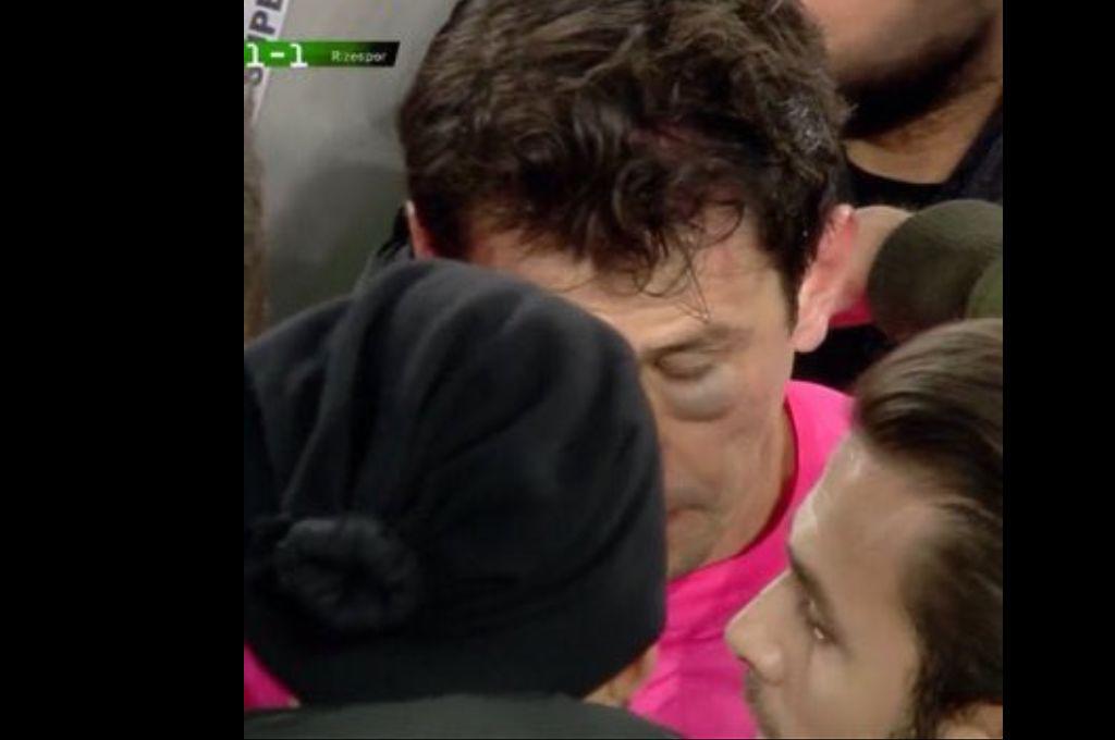 Con el ojo morado y pateado en el suelo: así quedó el árbitro tras ser golpeado por el presidente y jugadores de un equipo turco