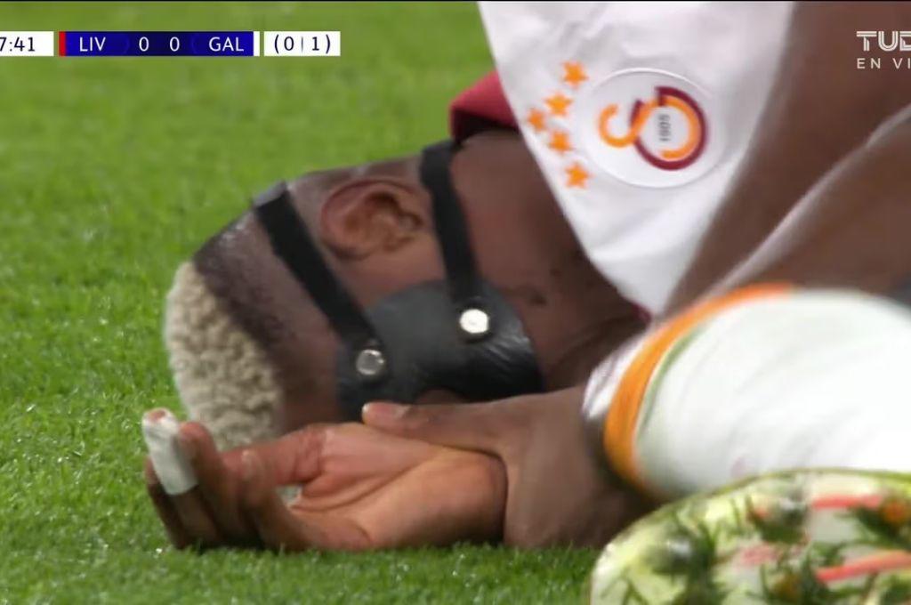 Amputaron su dedo tras ser eliminado de la Champions: la escalofríante imagen que se vivió en Anfield