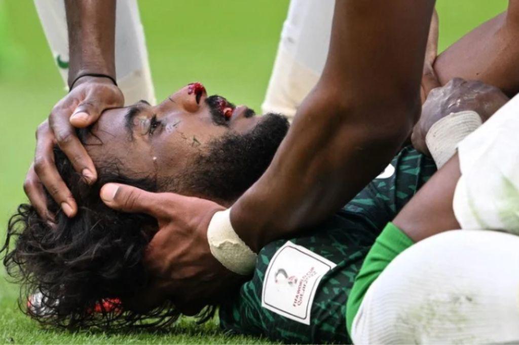 ¡Impactante momento! Confirman alcance de la lesión de Al Shahrani, jugador de Arabia Saudí tras vencer a Argentina