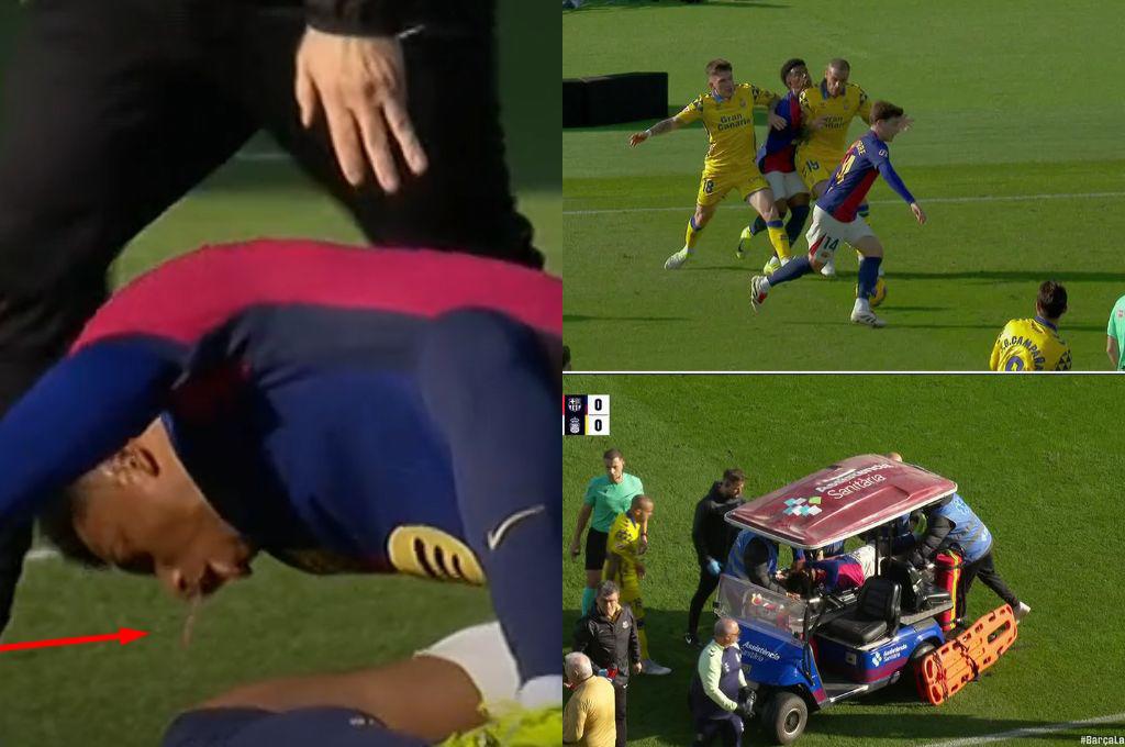 ¿Qué pasó con Alejandro Balde? Se marchó en camilla y vomitó sangre en el Barcelona vs Las Palmas