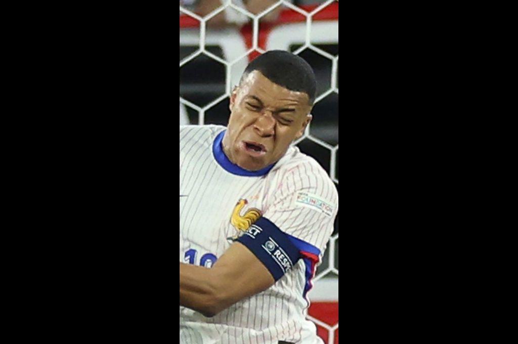 Fotos: Así le quedó la nariz a Mbappé tras rompérsela y lo que informan desde Francia sobre su lesión: “Es lo malo de esta noche”