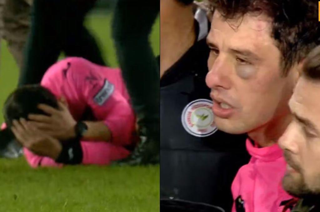 Con el ojo morado y pateado en el suelo: así quedó el árbitro tras ser golpeado por el presidente y jugadores de un equipo turco