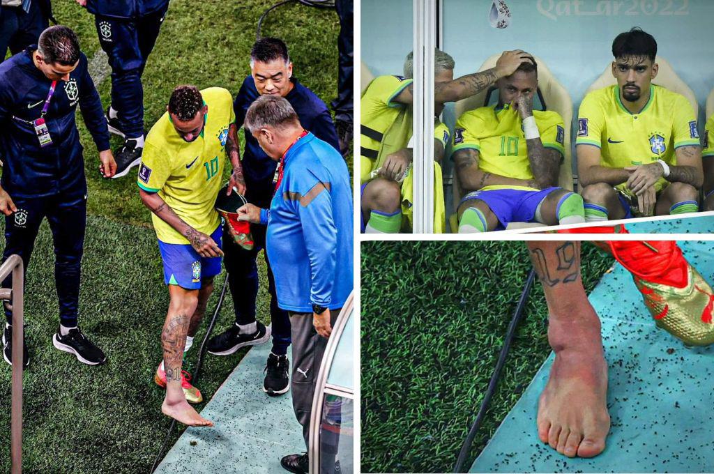 ¡Neymar lesionado! Qué tiene, cuánto tiempo estará de baja y qué partidos se perdería con Brasil en el Mundial Qatar 2022