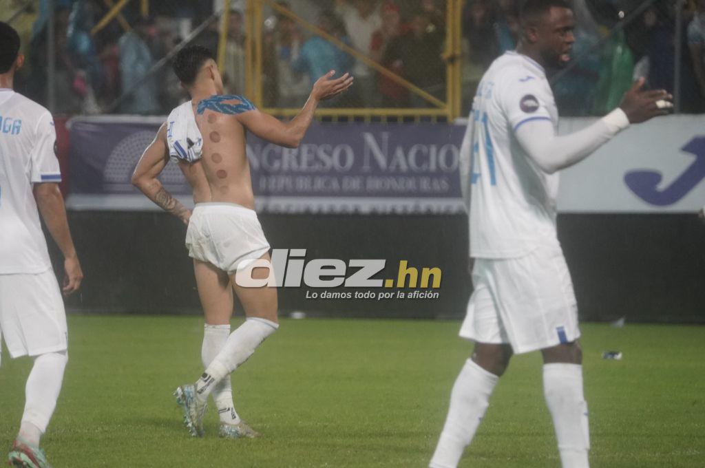 Bronca entre jugadores, el festejo de Honduras tras vencer a México y el feo gesto de Javier Aguirre, quien sufrió un corte en la cabeza