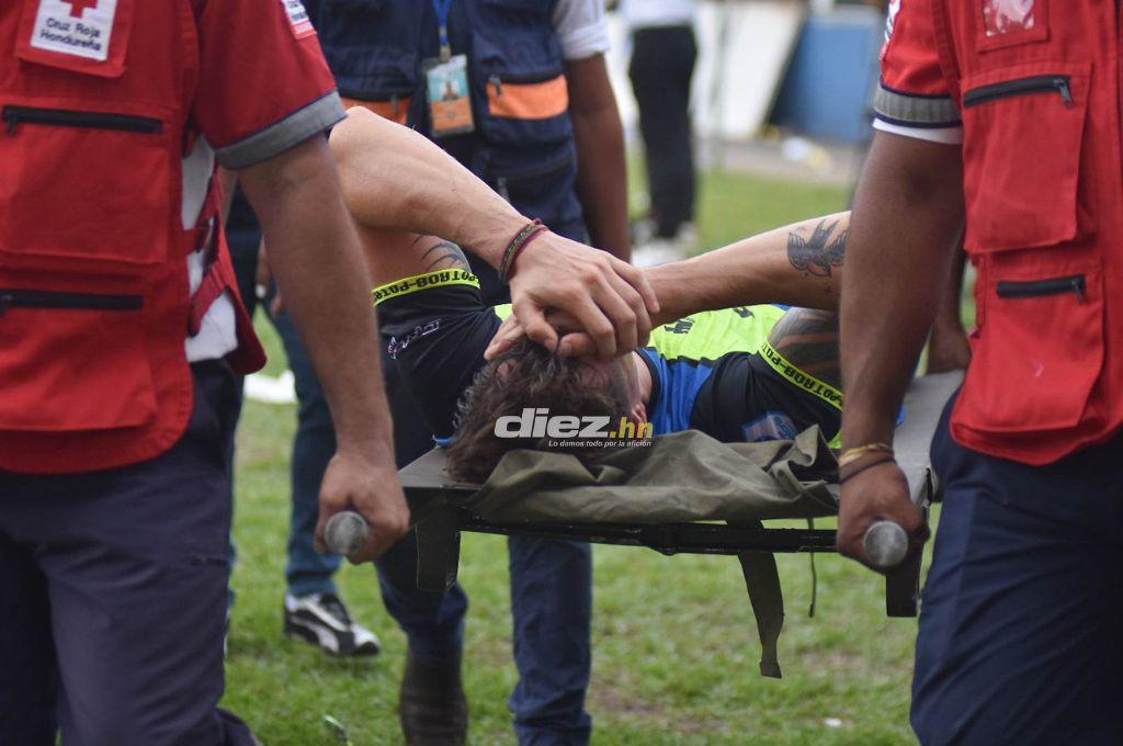 Las otras fotos que dejó la final Potros vs Olimpia: El jugador que se perdería la final de vuelta y la frustración del “Mango” Sánchez
