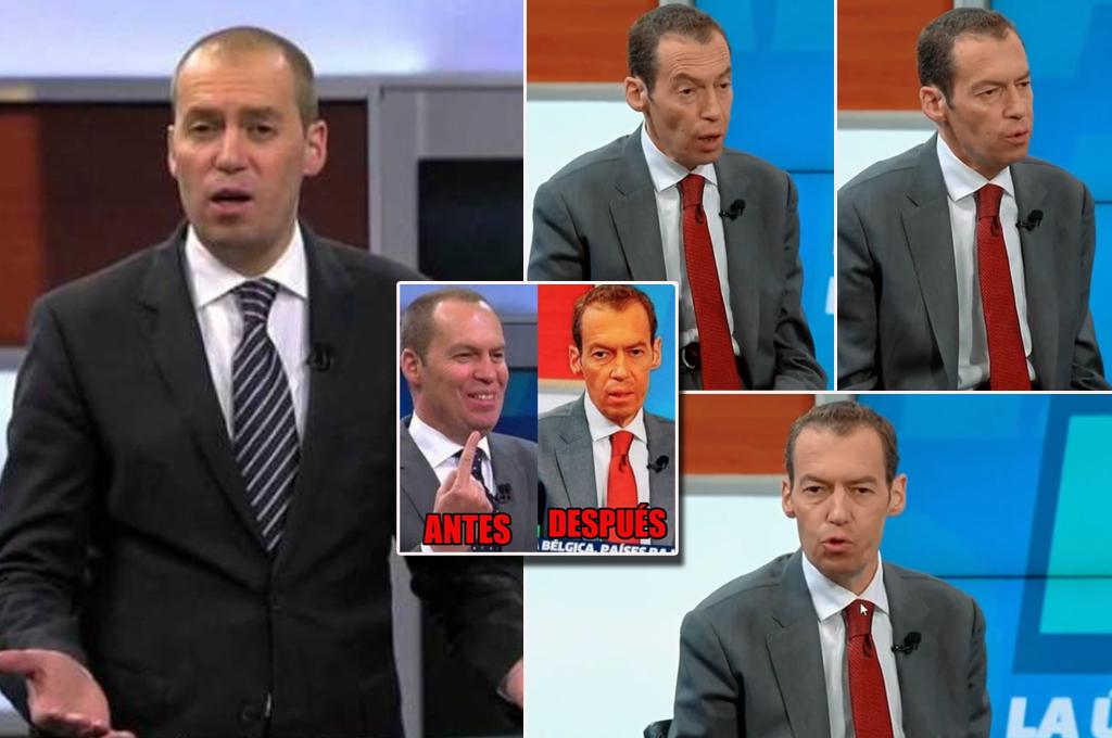 André Marín volvió a preocupar por su radical cambio físico: así luce ahora después de sufrir extraña enfermedad