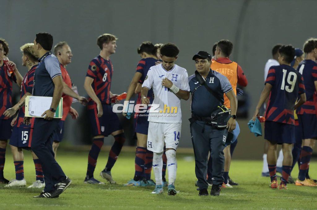 No se vio en TV: Las duras imágenes de los jugadores de Honduras, Luis Alvarado destrozado y el gesto de los estadounidenses